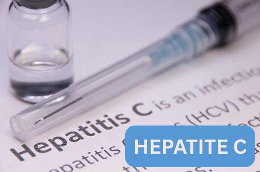 Hepatite C