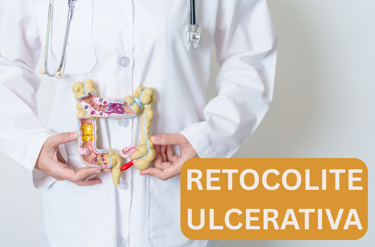 Retocolite ulcerativa