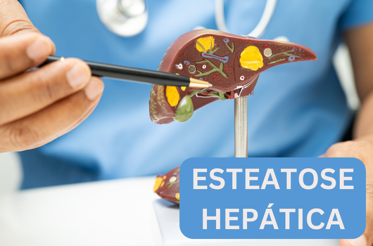 Esteatose hepática