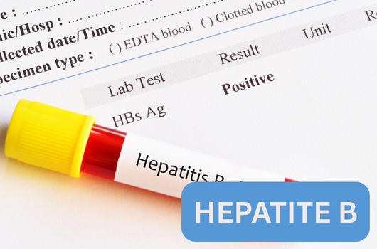 Hepatite B